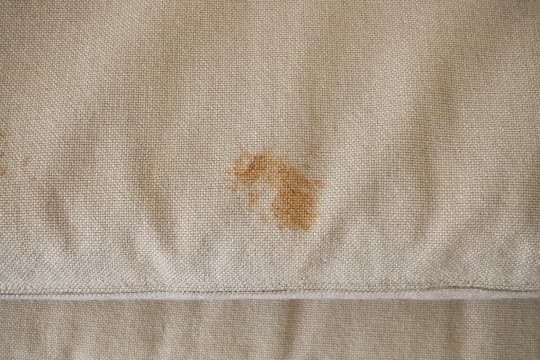 大きいシミの画像サンプル